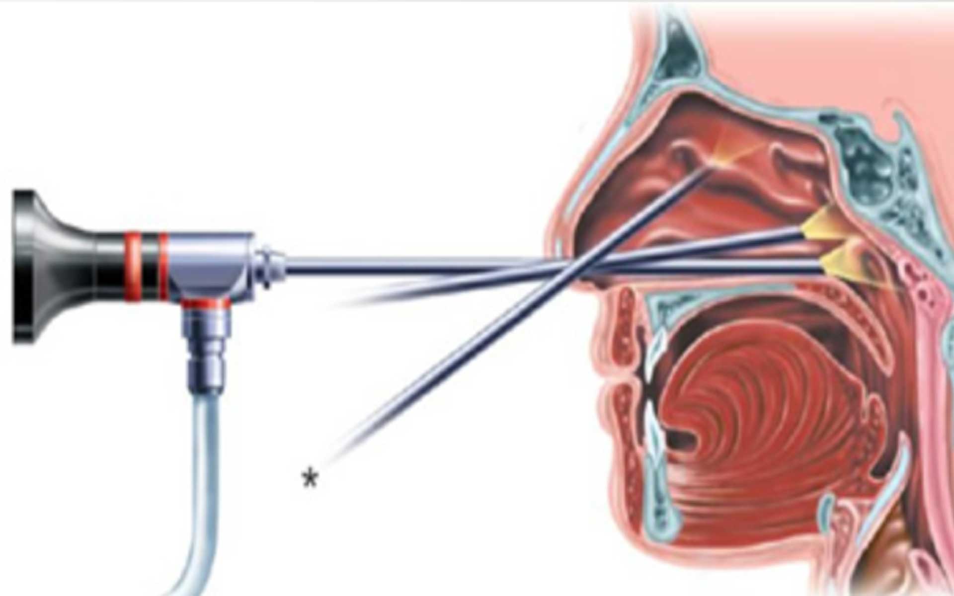 Docteur Olivier Bouchain, spécialiste ORL, chirurgie endoscopique base de crâne à Liège, Wallonie, Belgique.